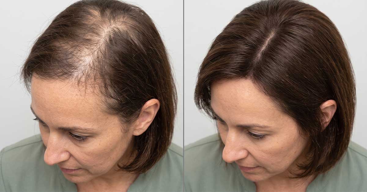 Why This Simple Hair Spray Is Getting So Much Attention